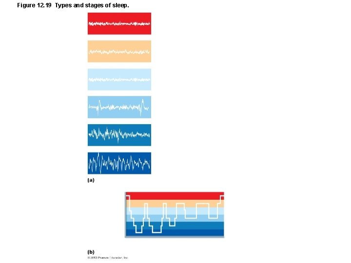 Figure 12. 19 Types and stages of sleep. 