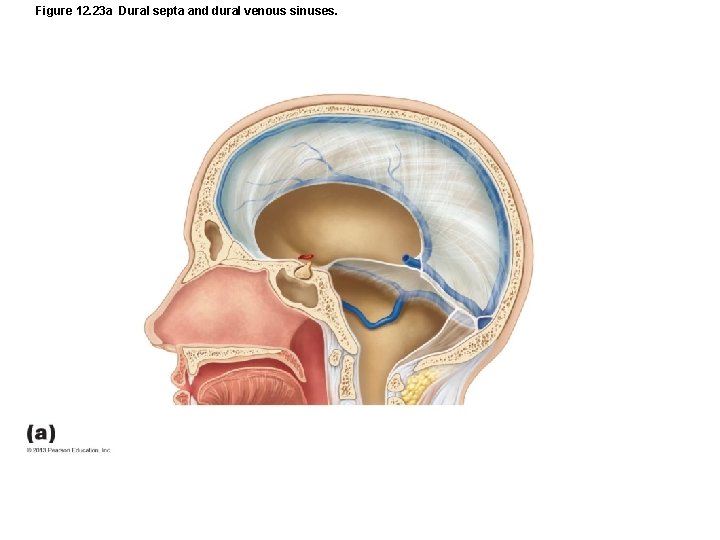 Figure 12. 23 a Dural septa and dural venous sinuses. 