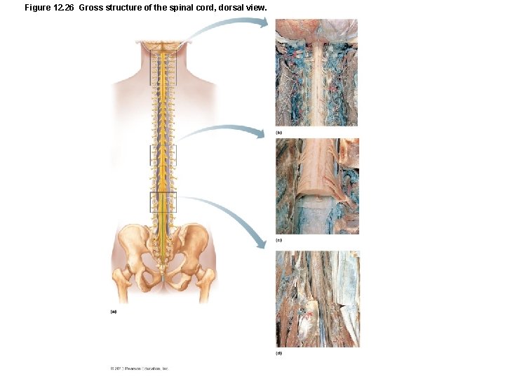 Figure 12. 26 Gross structure of the spinal cord, dorsal view. 