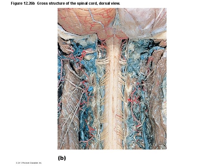 Figure 12. 26 b Gross structure of the spinal cord, dorsal view. 