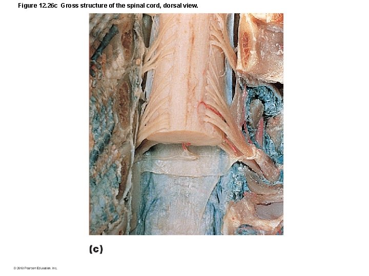 Figure 12. 26 c Gross structure of the spinal cord, dorsal view. 