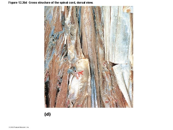 Figure 12. 26 d Gross structure of the spinal cord, dorsal view. 