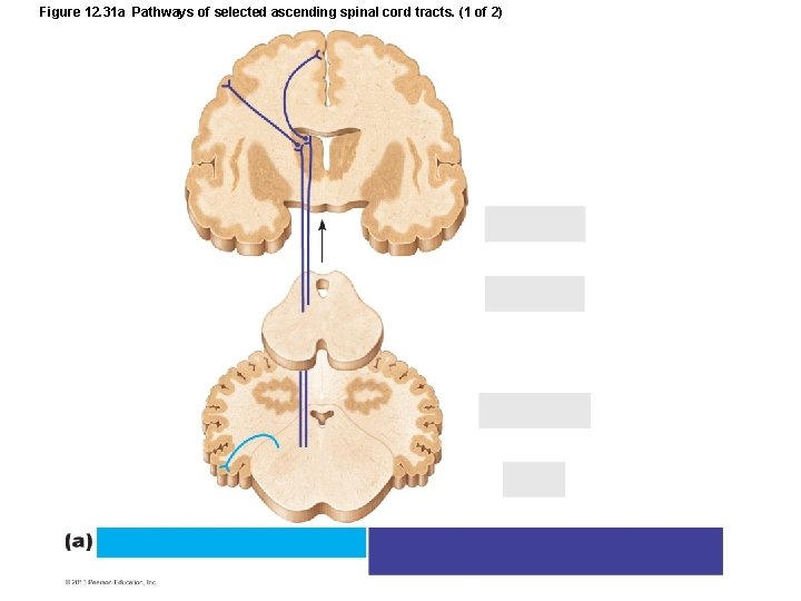 Figure 12. 31 a Pathways of selected ascending spinal cord tracts. (1 of 2)