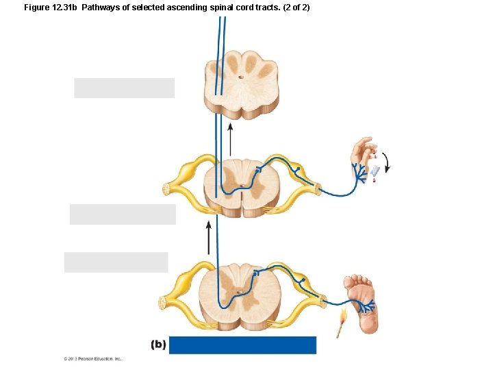 Figure 12. 31 b Pathways of selected ascending spinal cord tracts. (2 of 2)