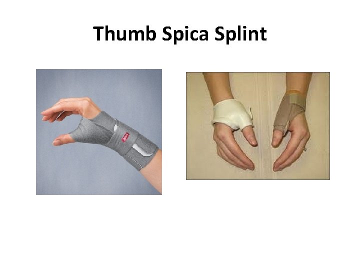 Thumb Spica Splint 