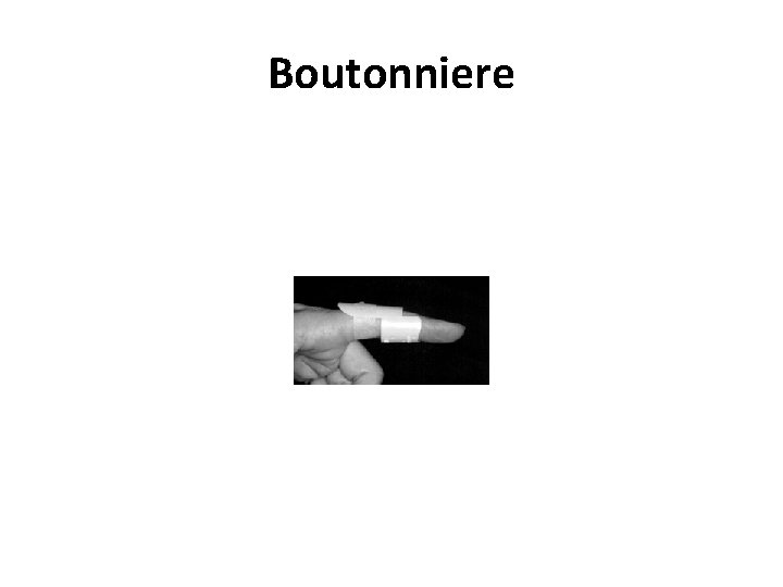 Boutonniere 