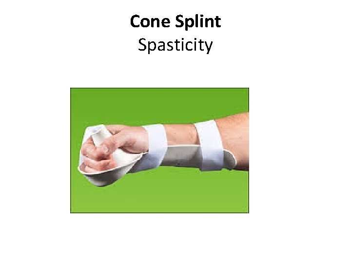 Cone Splint Spasticity 