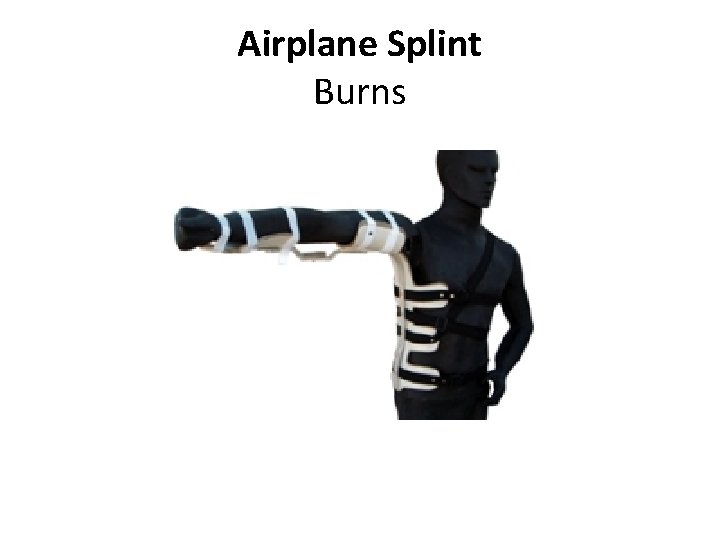 Airplane Splint Burns 