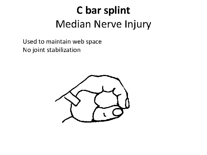 C bar splint Median Nerve Injury Used to maintain web space No joint stabilization