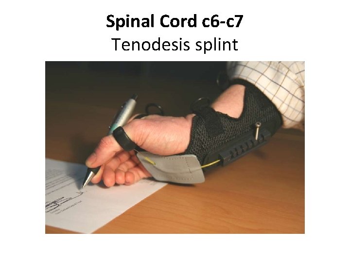 Spinal Cord c 6 -c 7 Tenodesis splint 