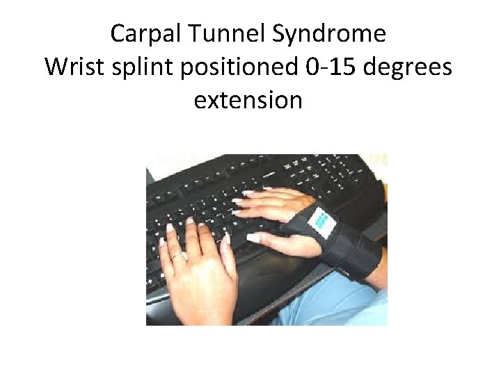 Carpal Tunnel Syndrome Wrist splint positioned 0 -15 degrees extension 