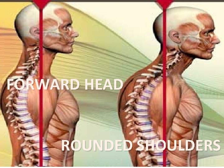 FORWARD HEAD ROUNDED SHOULDERS 