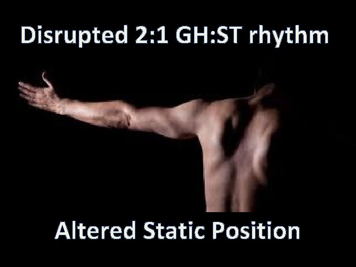 Disrupted 2: 1 GH: ST rhythm Altered Static Position 