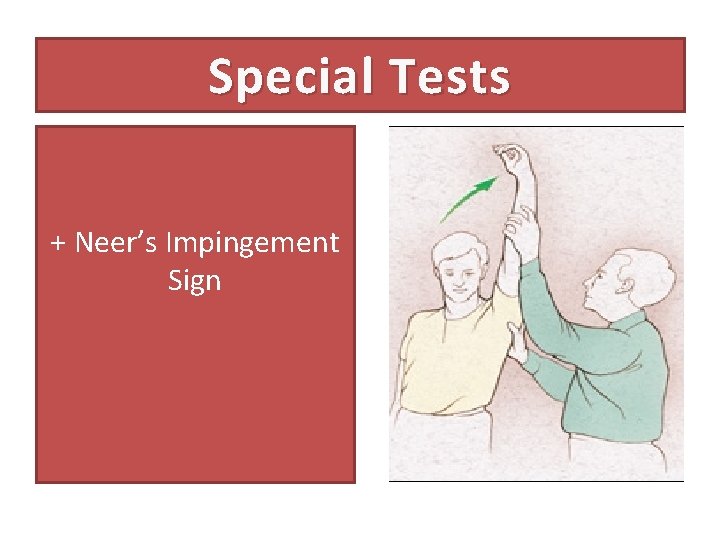 Special Tests + Neer’s Impingement Sign 