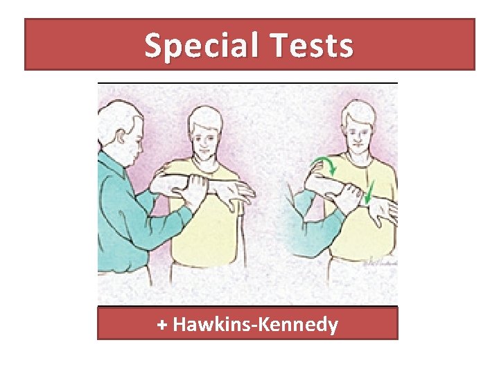 Special Tests + Hawkins-Kennedy 