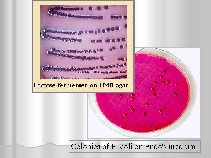Colonies of E. coli on Endo's medium 