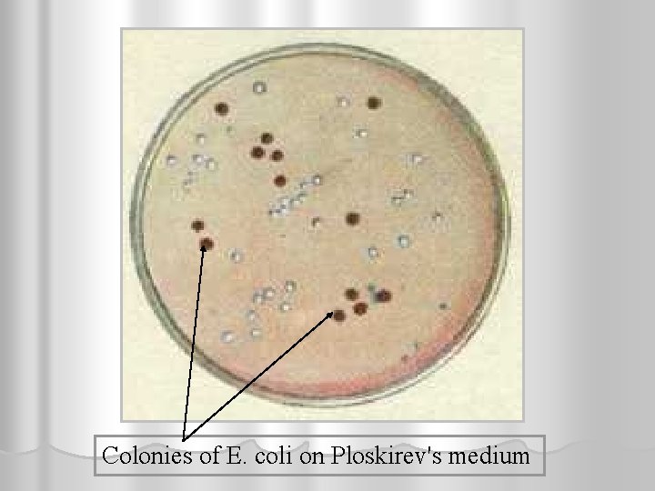 Colonies of E. coli on Ploskirev's medium 