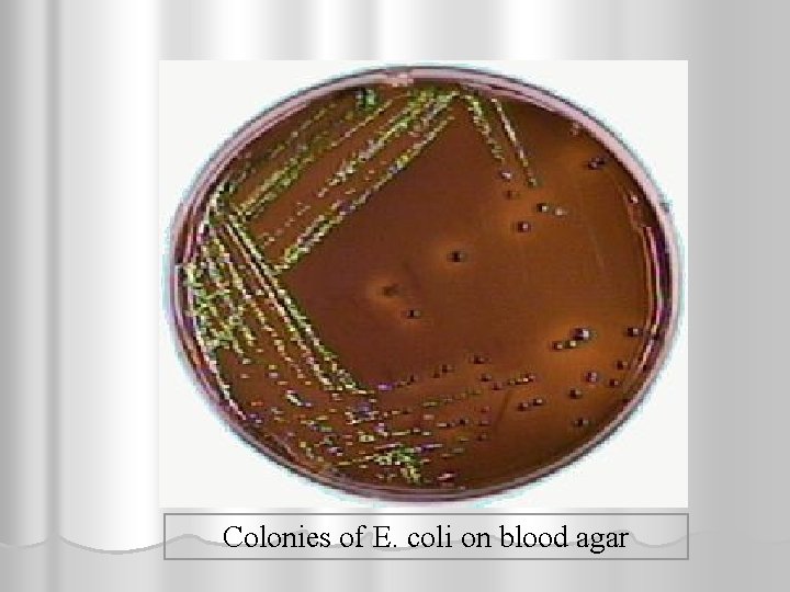 Colonies of E. coli on blood agar 