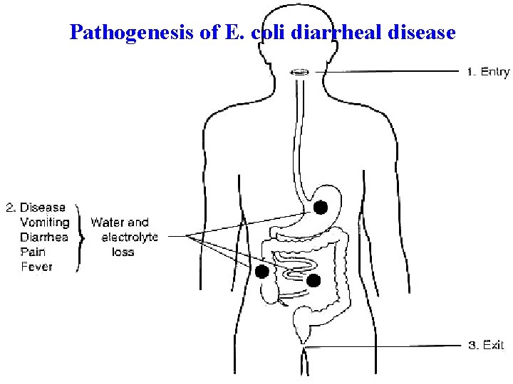 Pathogenesis of E. coli diarrheal disease 