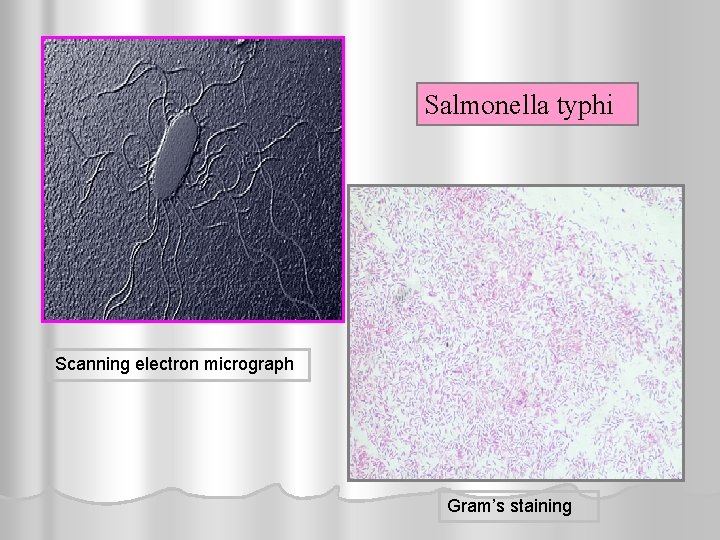 Salmonella typhi Scanning electron micrograph Gram’s staining 