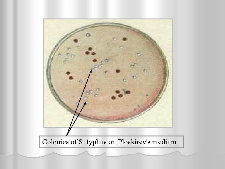 Colonies of S. typhus on Ploskirev's medium 