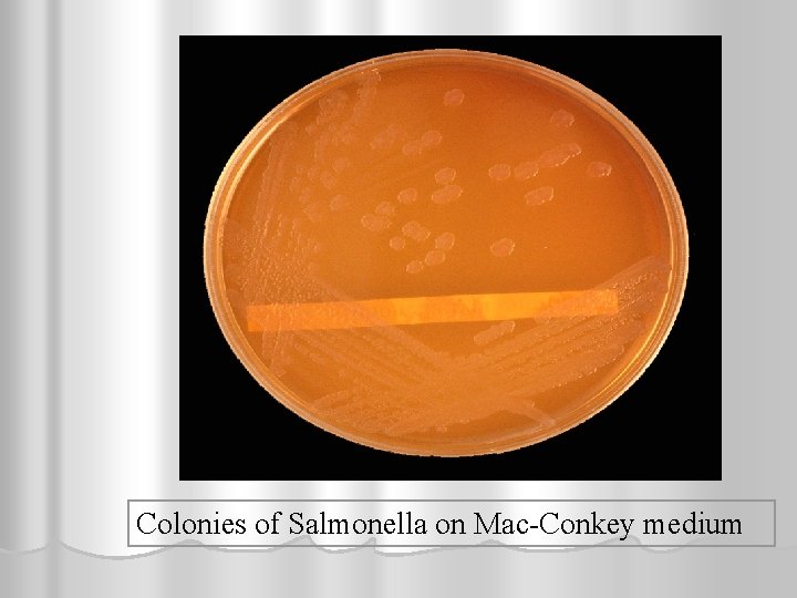 Colonies of Salmonella on Mac-Conkey medium 