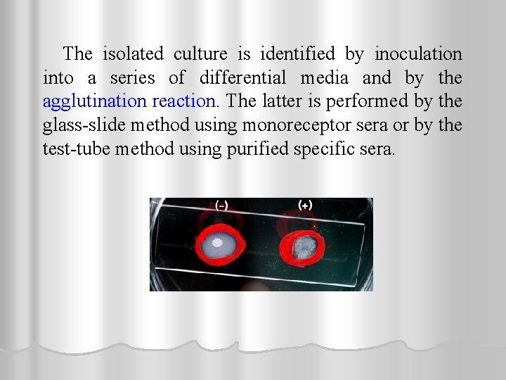 The isolated culture is identified by inoculation into a series of differential media and