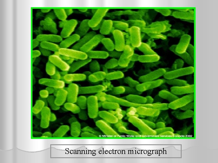 Scanning electron micrograph 