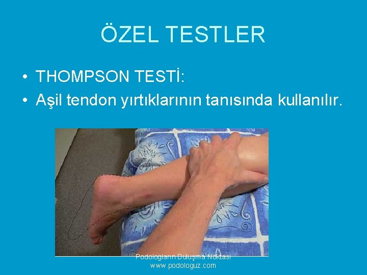 ÖZEL TESTLER • THOMPSON TESTİ: • Aşil tendon yırtıklarının tanısında kullanılır. Podologların Buluşma Noktası