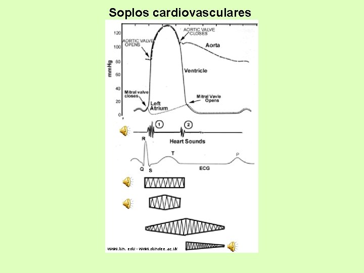 Soplos cardiovasculares www. iun. edu - www. dundee. ac. uk 