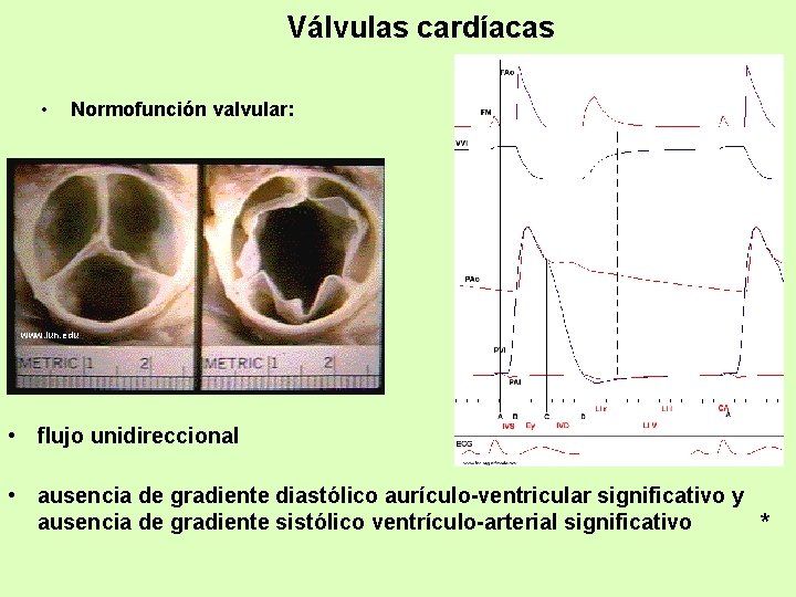 Válvulas cardíacas • Normofunción valvular: www. iun. edu • flujo unidireccional • ausencia de