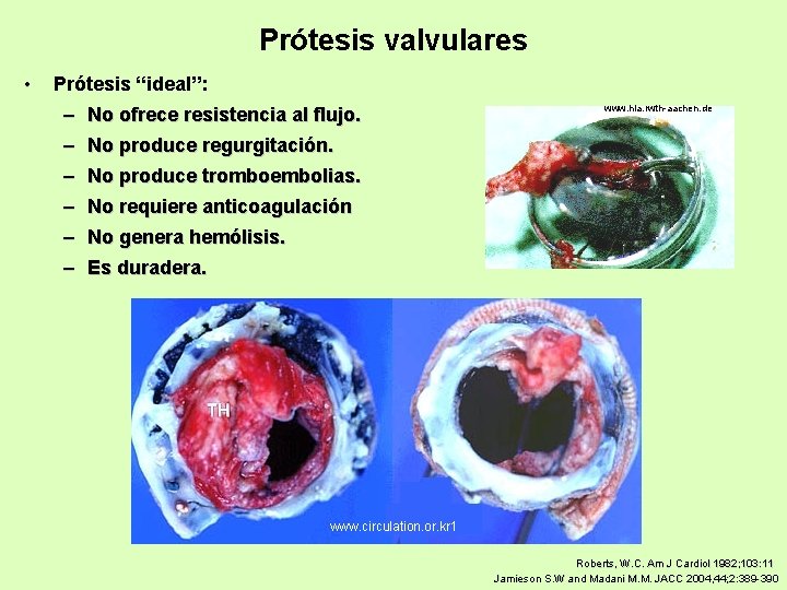 Prótesis valvulares • Prótesis “ideal”: – No ofrece resistencia al flujo. – No produce