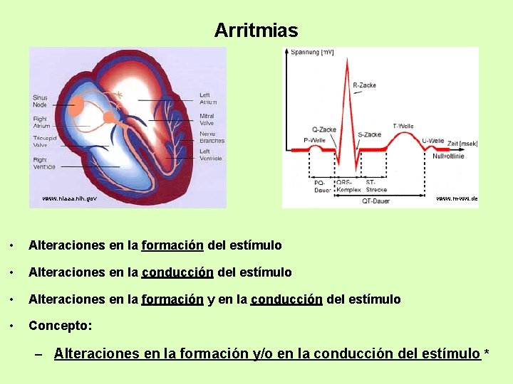 Arritmias www. niaaa. nih. gov • Alteraciones en la formación del estímulo • Alteraciones