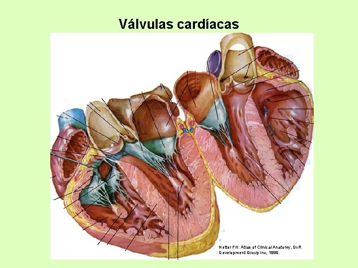 Válvulas cardíacas Netter FH: Atlas of Clinical Anatomy, Dx. R Development Group Inc, 1999.
