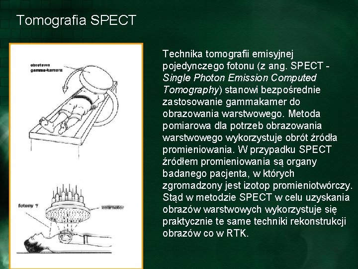 Tomografia SPECT Technika tomografii emisyjnej pojedynczego fotonu (z ang. SPECT Single Photon Emission Computed