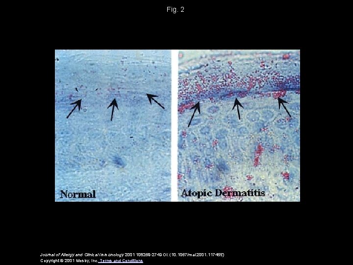 Fig. 2 Journal of Allergy and Clinical Immunology 2001 108269 -274 DOI: (10. 1067/mai.