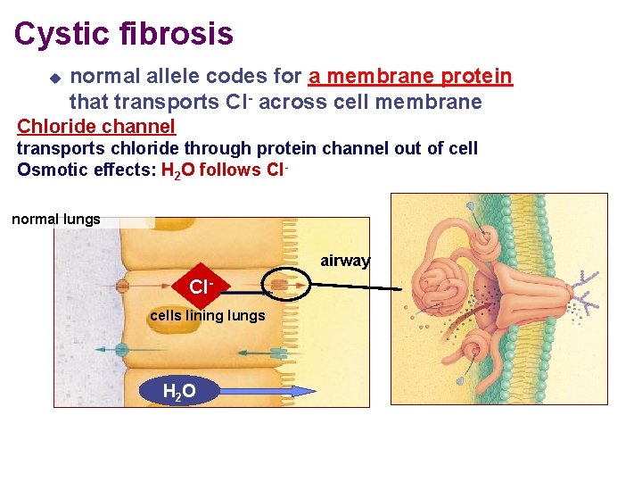 Cystic fibrosis normal allele codes for a membrane protein that transports Cl- across cell