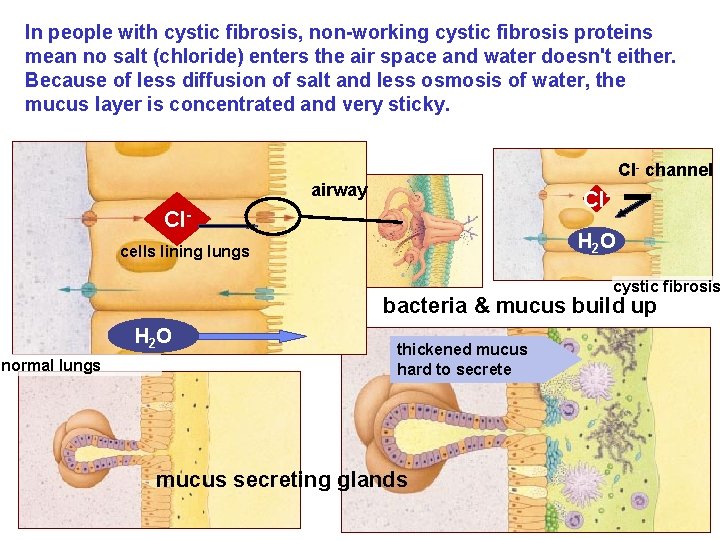In people with cystic fibrosis, non-working cystic fibrosis proteins mean no salt (chloride) enters