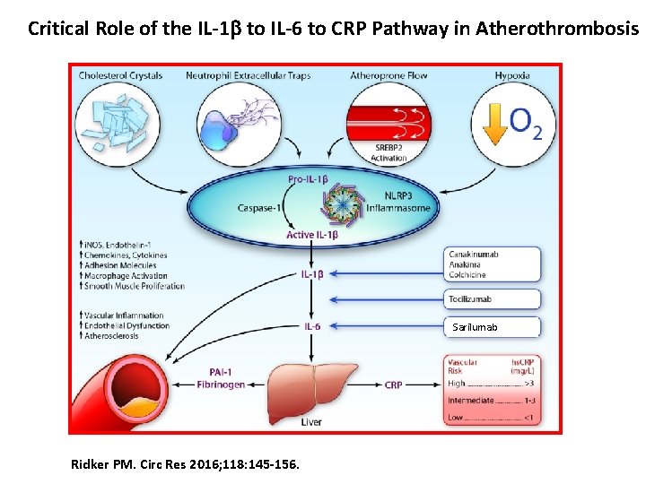 Critical Role of the IL-1 b to IL-6 to CRP Pathway in Atherothrombosis Sarilumab
