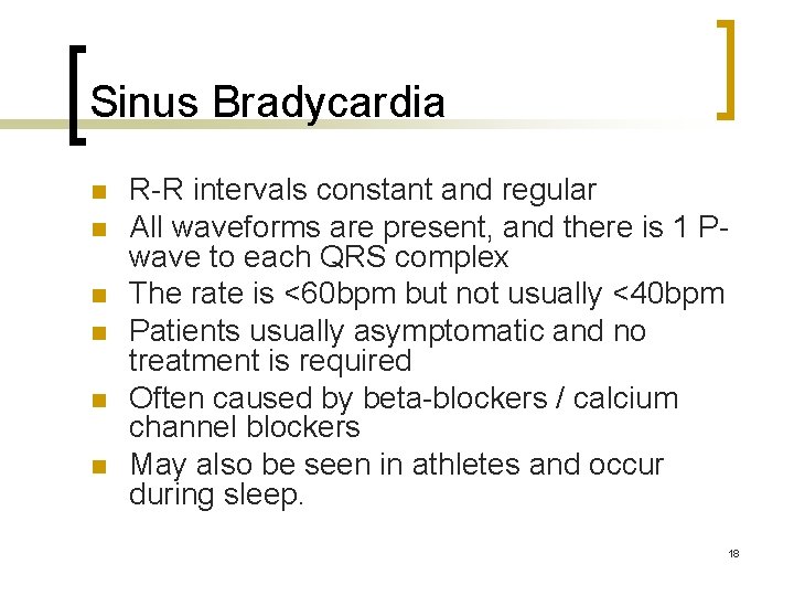 Sinus Bradycardia n n n R-R intervals constant and regular All waveforms are present,