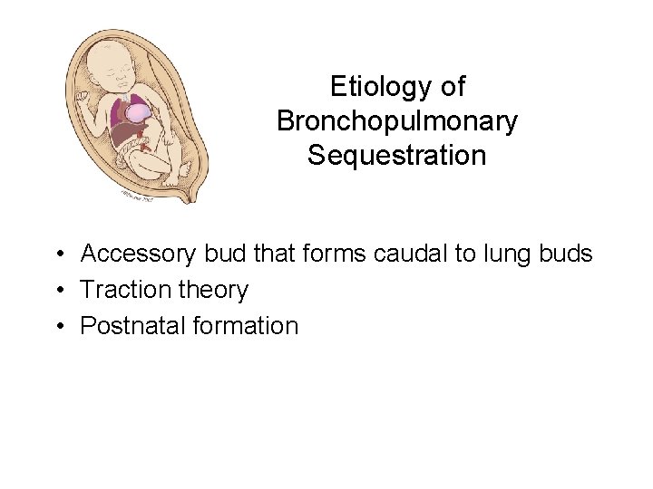 Etiology of Bronchopulmonary Sequestration • Accessory bud that forms caudal to lung buds •