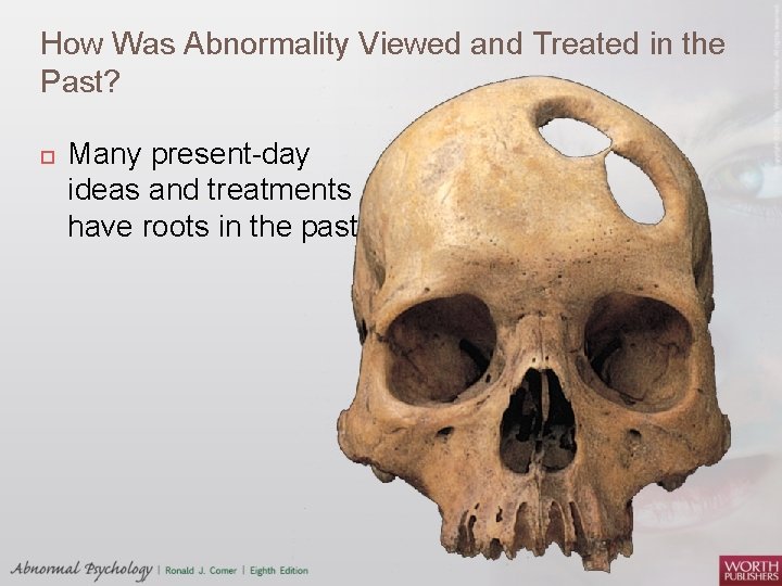 How Was Abnormality Viewed and Treated in the Past? Many present-day ideas and treatments