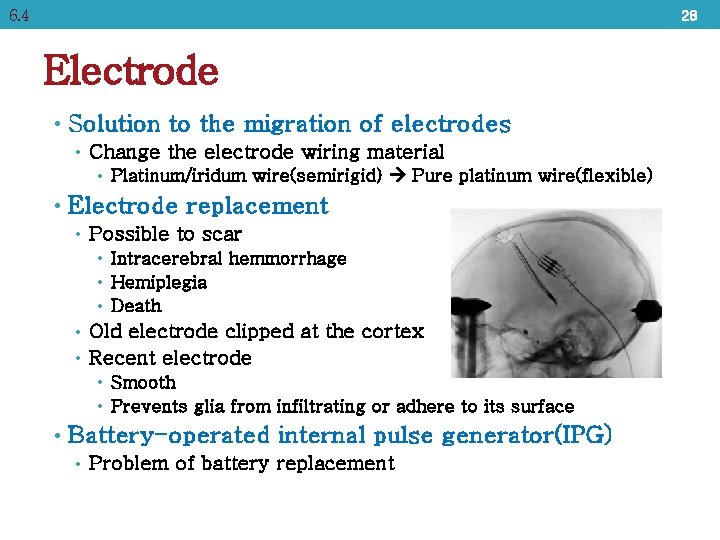 6. 4 28 Electrode • Solution to the migration of electrodes • Change the