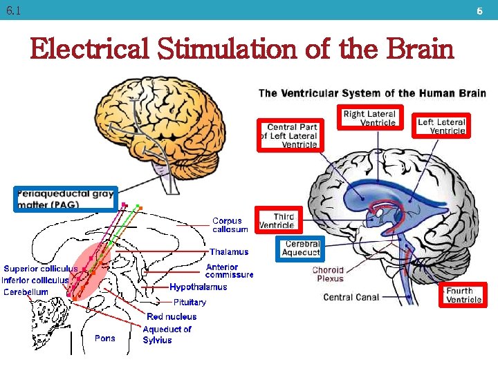 6. 1 5 Electrical Stimulation of the Brain 