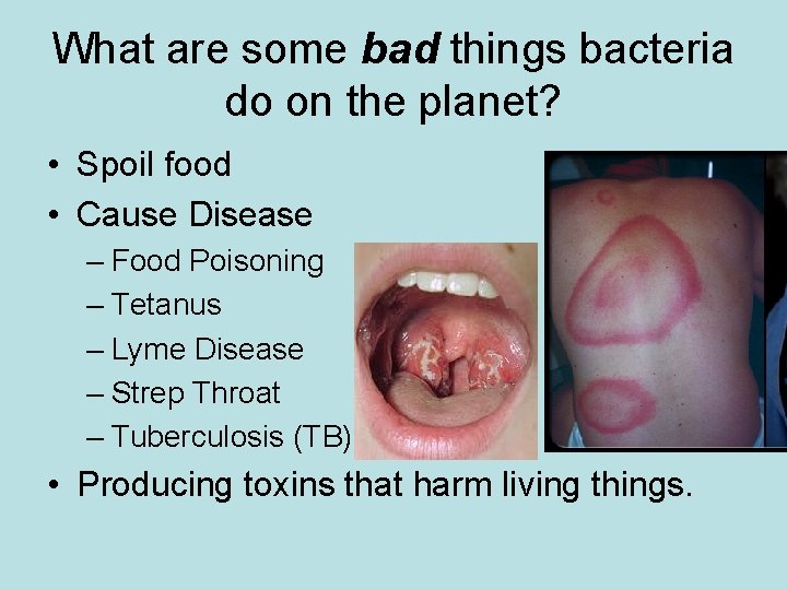 What are some bad things bacteria do on the planet? • Spoil food •