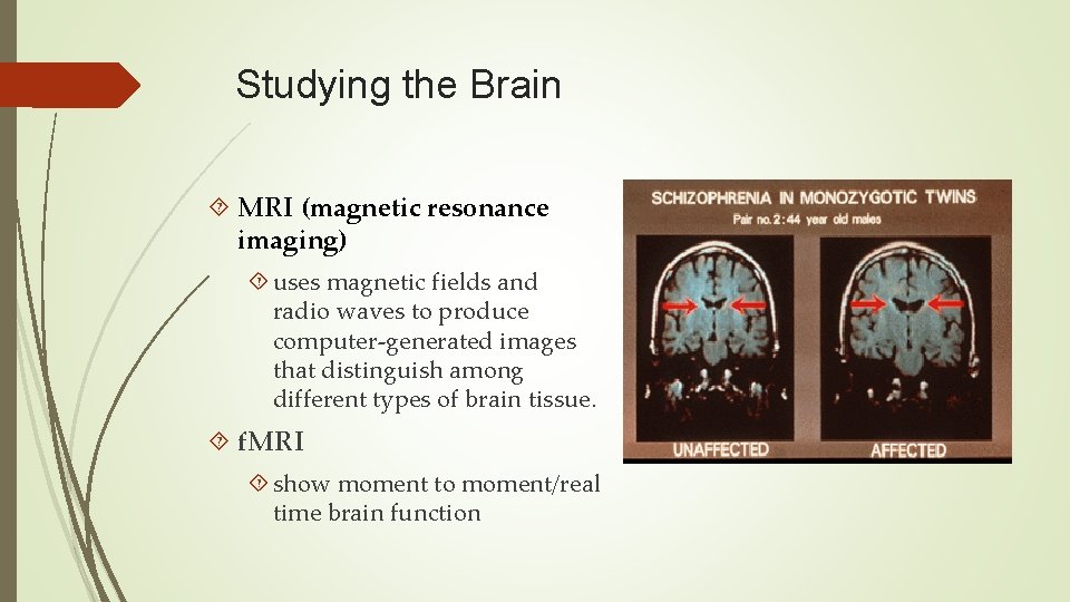 Studying the Brain MRI (magnetic resonance imaging) uses magnetic fields and radio waves to
