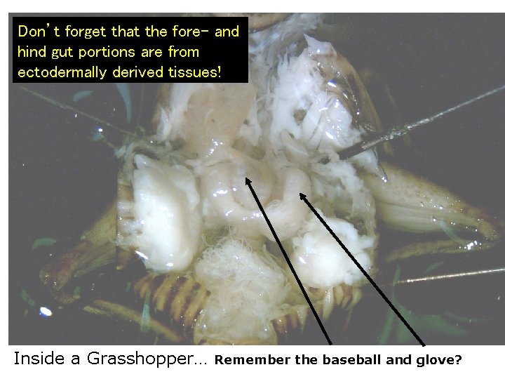 Don’t forget that the fore- and hind gut portions are from ectodermally derived tissues!