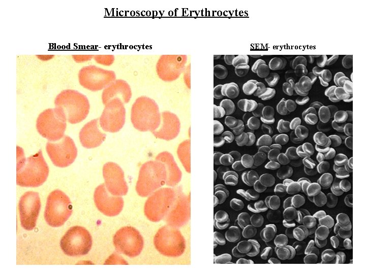 Microscopy of Erythrocytes Blood Smear- erythrocytes SEM- erythrocytes 