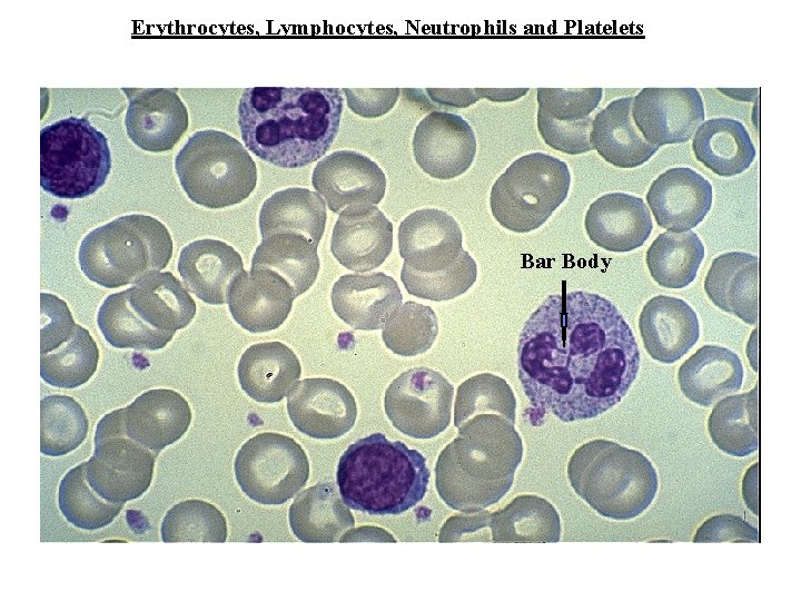 Erythrocytes, Lymphocytes, Neutrophils and Platelets Bar Body 