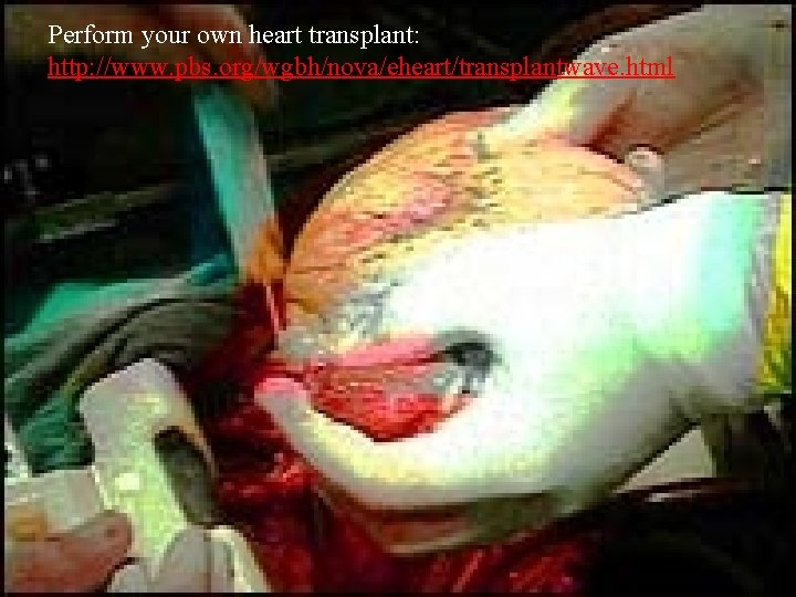 Perform your own heart transplant: http: //www. pbs. org/wgbh/nova/eheart/transplantwave. html 